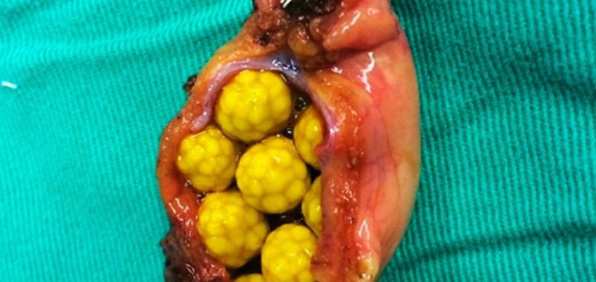 Cirugía Gastrointestinal